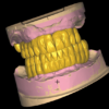 Full Anatomic and temporary crowns