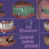 I will design high quality crown and bridge dental restorations in exocad